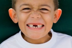 Giải mã giấc mơ thấy gãy răng