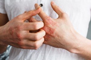 Mỗi chiêm bao bị thương đều ẩn chứa những con số đặc biệt